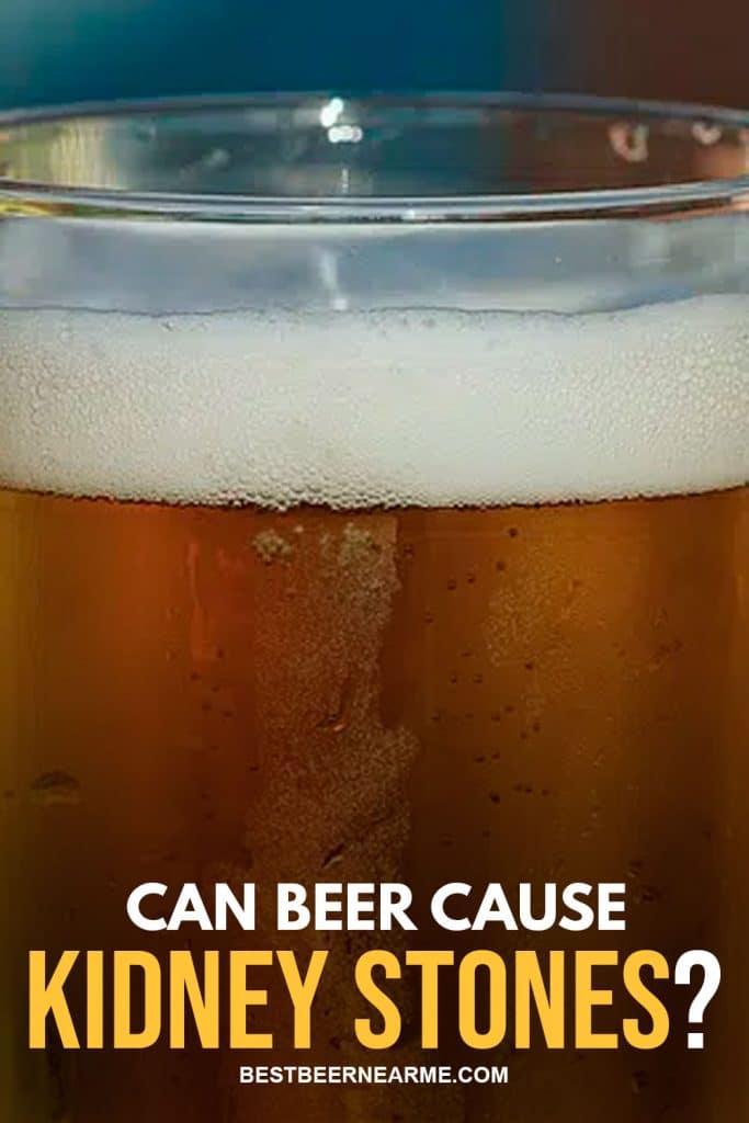 Can Beer Cause Kidney Stones